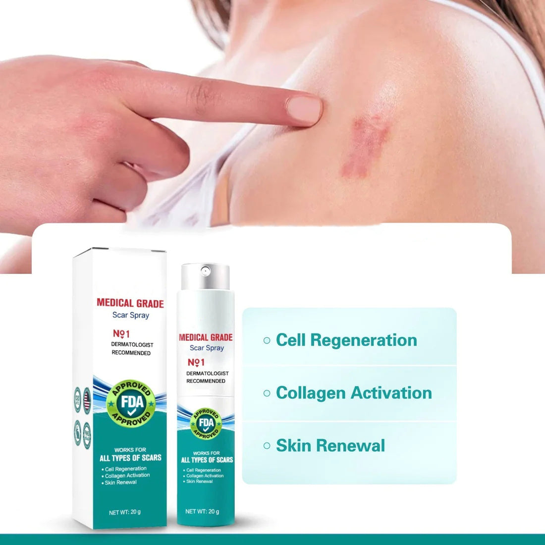 ❤️Advacnced Scar Spray For All Types of Scars- For Example Acne Scars, Surgical Scars and Stretch Marks⚡⚡⚡