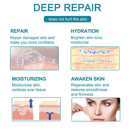 ❤️Advacnced Scar Spray For All Types of Scars- For Example Acne Scars, Surgical Scars and Stretch Marks⚡⚡⚡